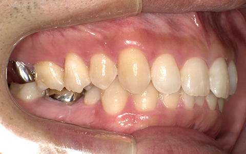 Before image
