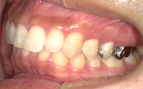 Before image
