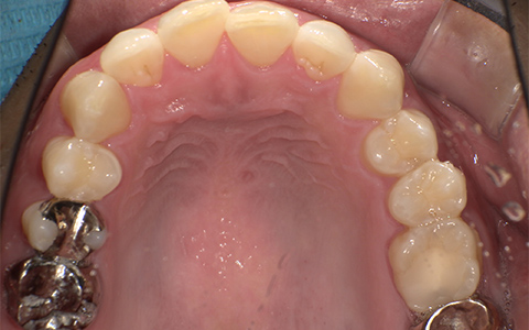 Before image