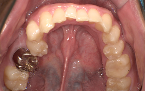Before image