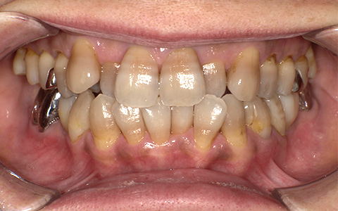 After image