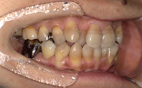 After image