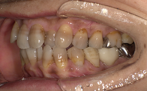After image