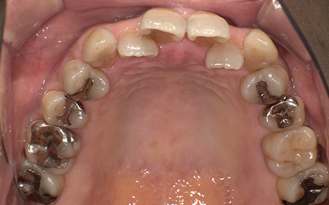 After image
