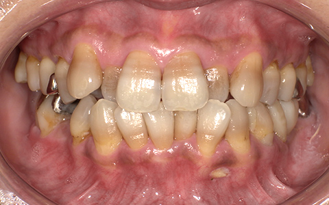 Before image