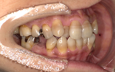 Before image