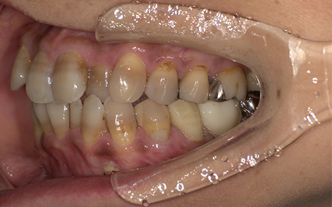 Before image