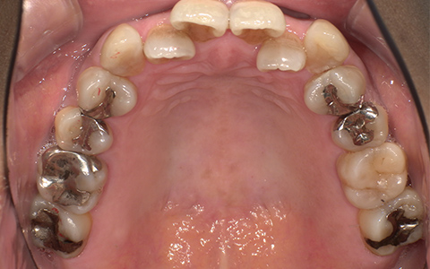 Before image