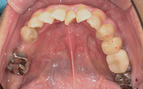 Before image