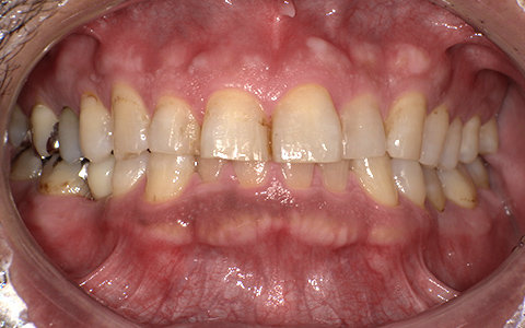 After image