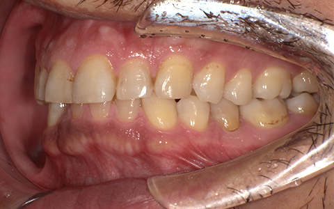 After image