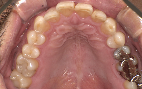 After image
