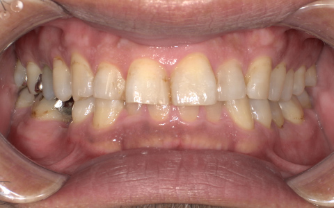 Before image