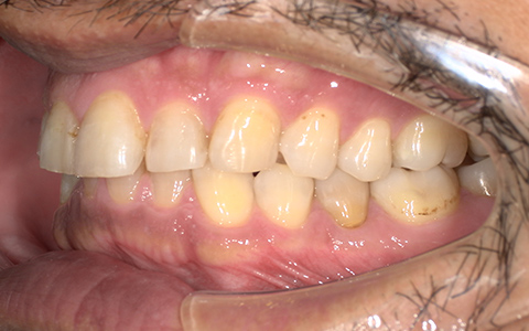 Before image