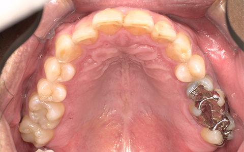 Before image