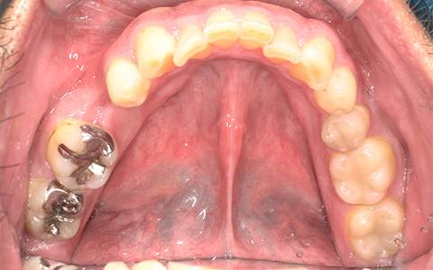 Before image
