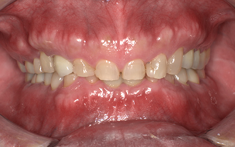 After image