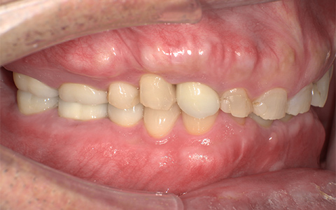 After image