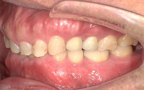 After image