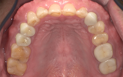 After image