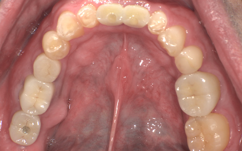 After image