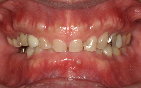 Before image