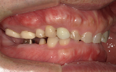 Before image