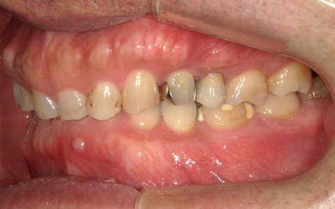 Before image