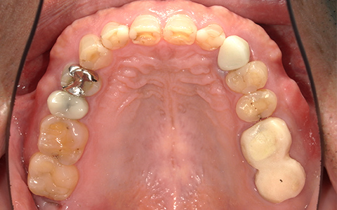 Before image