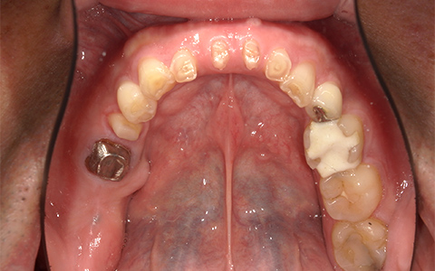Before image