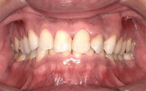 After image