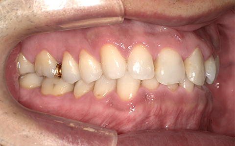 After image