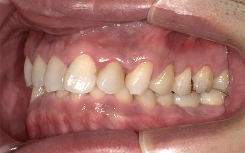 After image