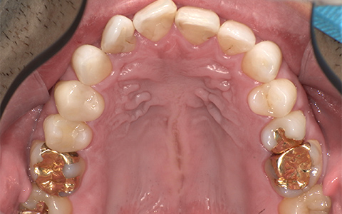After image