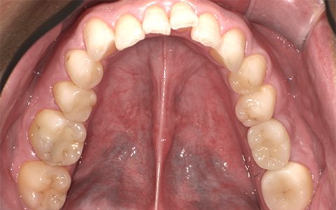 After image