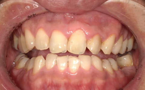 Before image