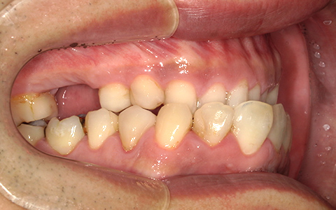 Before image