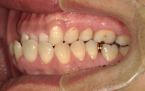 Before image