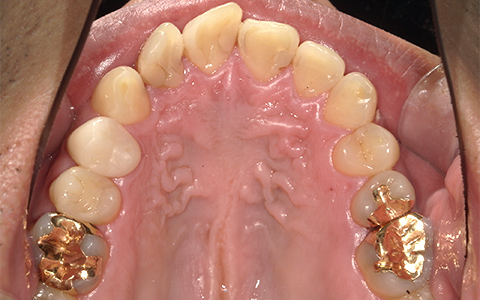 Before image