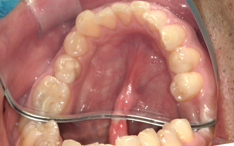 Before image