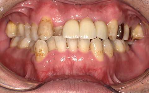 After image