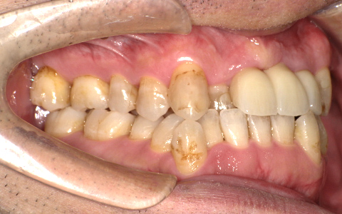 After image
