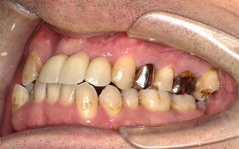 After image