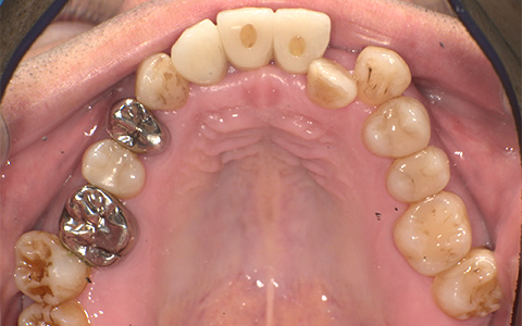 After image