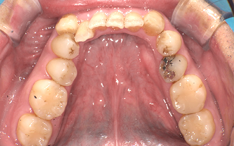 After image