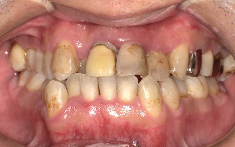 Before image