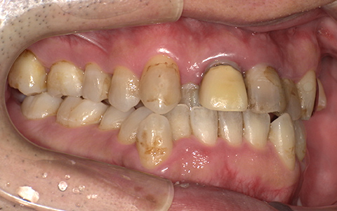 Before image
