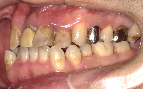 Before image