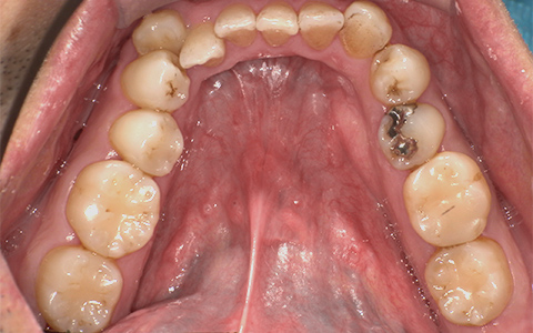 Before image