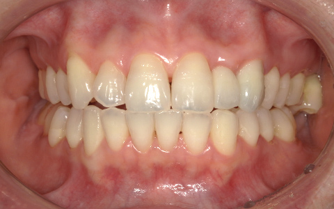 After image